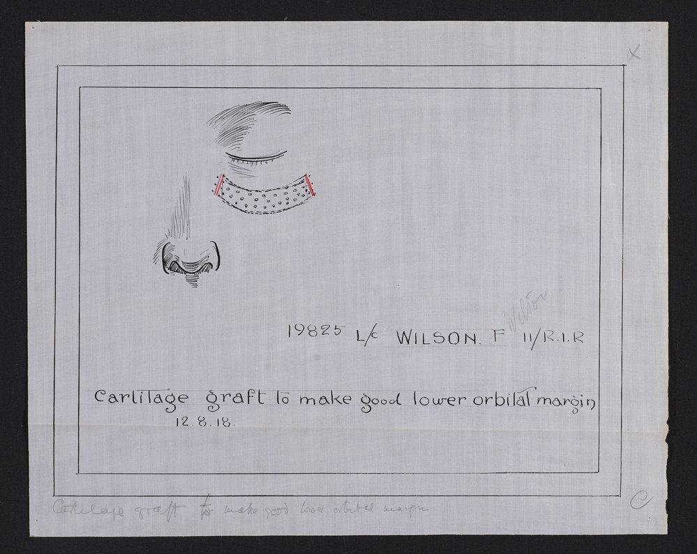 Wilson drawing 2